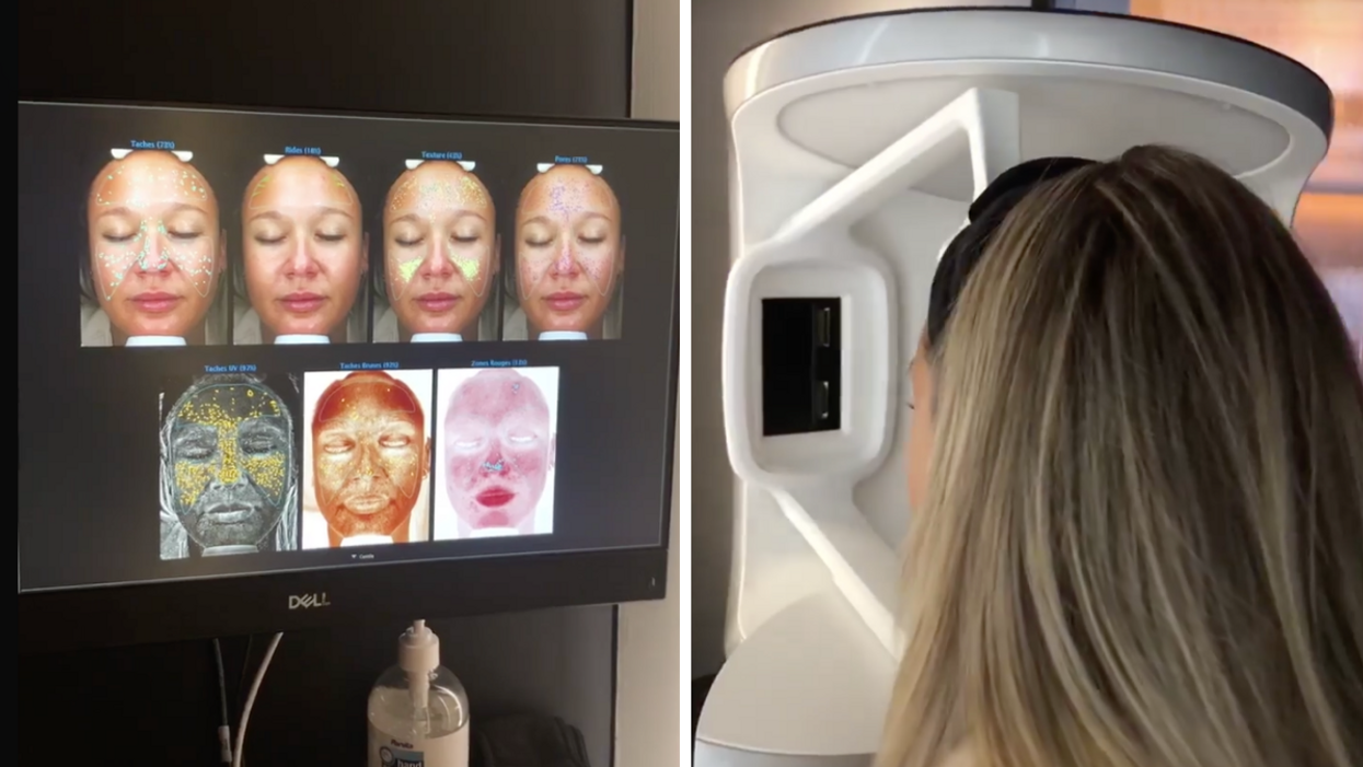 Le tout premier SkinLab au Canada a ouvert à 2 h de Montréal et je l'ai essayé